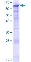 KIAA1841 Protein - 12.5% SDS-PAGE of human KIAA1841 stained with Coomassie Blue