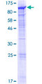 KIAA1841 Protein - 12.5% SDS-PAGE of human KIAA1841 stained with Coomassie Blue