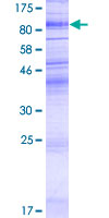 KIAA1919 / NAGLT1 Protein - 12.5% SDS-PAGE of human KIAA1919 stained with Coomassie Blue