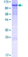 KIAA1958 Protein - 12.5% SDS-PAGE of human KIAA1958 stained with Coomassie Blue