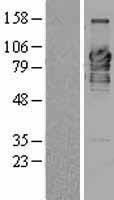 KIAA1984 / PARF Protein - Western validation with an anti-DDK antibody * L: Control HEK293 lysate R: Over-expression lysate