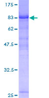 KIAA1984 / PARF Protein - 12.5% SDS-PAGE of human C9orf86 stained with Coomassie Blue