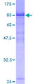 KIAA1984 / PARF Protein - 12.5% SDS-PAGE of human C9orf86 stained with Coomassie Blue