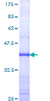 KIF16B Protein - 12.5% SDS-PAGE Stained with Coomassie Blue.