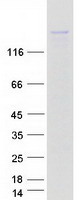 KIF16B Protein - Purified recombinant protein KIF16B was analyzed by SDS-PAGE gel and Coomassie Blue Staining