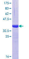 KIF17 Protein - 12.5% SDS-PAGE Stained with Coomassie Blue.