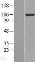 KIF18A Protein - Western validation with an anti-DDK antibody * L: Control HEK293 lysate R: Over-expression lysate