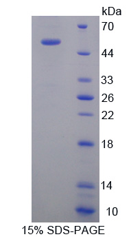 KIF18A Protein - Recombinant  Kinesin Family, Member 18A By SDS-PAGE