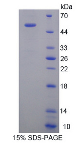 KIF18A Protein - Recombinant  Kinesin Family, Member 18A By SDS-PAGE