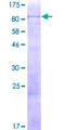 KIF19 Protein - 12.5% SDS-PAGE of human KIF19 stained with Coomassie Blue