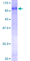 KIF1B / CMT2 Protein - 12.5% SDS-PAGE of human KIF1B stained with Coomassie Blue