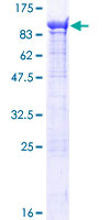 KIF1BP Protein - 12.5% SDS-PAGE of human KIAA1279 stained with Coomassie Blue