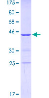 KIF1C Protein - 12.5% SDS-PAGE Stained with Coomassie Blue.