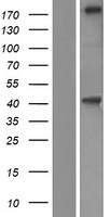 KIF21B Protein - Western validation with an anti-DDK antibody * L: Control HEK293 lysate R: Over-expression lysate
