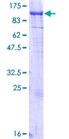 KIF2C / MCAK Protein - 12.5% SDS-PAGE of human KIF2C stained with Coomassie Blue