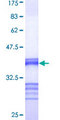 KIF2C / MCAK Protein - 12.5% SDS-PAGE Stained with Coomassie Blue.