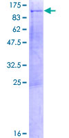 KIF3B Protein - 12.5% SDS-PAGE of human KIF3B stained with Coomassie Blue