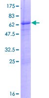 KIF6 Protein - 12.5% SDS-PAGE of human KIF6 stained with Coomassie Blue