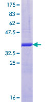 KIF9 Protein - 12.5% SDS-PAGE Stained with Coomassie Blue.