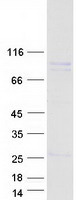 KIF9 Protein - Purified recombinant protein KIF9 was analyzed by SDS-PAGE gel and Coomassie Blue Staining