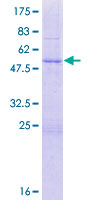 KIFC2 / Kinesin C2 Protein - 12.5% SDS-PAGE of human KIFC2 stained with Coomassie Blue