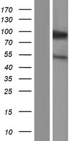 KIFC3 Protein - Western validation with an anti-DDK antibody * L: Control HEK293 lysate R: Over-expression lysate