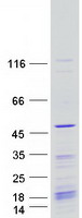 KIN17 / KIN Protein - Purified recombinant protein KIN was analyzed by SDS-PAGE gel and Coomassie Blue Staining