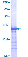 Kinesin-Like 7 / KIF15 Protein - 12.5% SDS-PAGE Stained with Coomassie Blue.