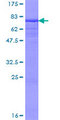 KIR2DL1 / CD158a Protein - 12.5% SDS-PAGE of human KIR2DL1 stained with Coomassie Blue