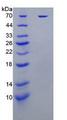 KIR2DL1 / CD158a Protein - Recombinant Killer Cell Immunoglobulin Like Receptor 2DL1 By SDS-PAGE