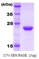 KIR2DL1 / CD158a Protein