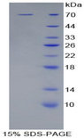 KIR2DL2 / CD158b Protein - Recombinant Killer Cell Immunoglobulin Like Receptor 2DL2 By SDS-PAGE