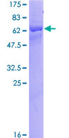 KIR2DL3 / CD152B2 Protein - 12.5% SDS-PAGE of human KIR2DL3 stained with Coomassie Blue