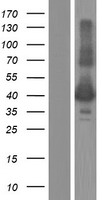 KIR2DL4 Protein - Western validation with an anti-DDK antibody * L: Control HEK293 lysate R: Over-expression lysate