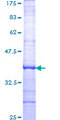 KIR2DL4 Protein - 12.5% SDS-PAGE Stained with Coomassie Blue.