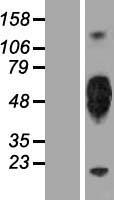 KIR2DL5A / KIR2DL5 Protein - Western validation with an anti-DDK antibody * L: Control HEK293 lysate R: Over-expression lysate