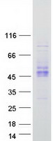 KIR2DS2 / CD158j Protein - Purified recombinant protein KIR2DS2 was analyzed by SDS-PAGE gel and Coomassie Blue Staining