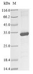KIR2DS3 Protein - (Tris-Glycine gel) Discontinuous SDS-PAGE (reduced) with 5% enrichment gel and 15% separation gel.