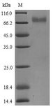 KIR2DS3 Protein - (Tris-Glycine gel) Discontinuous SDS-PAGE (reduced) with 5% enrichment gel and 15% separation gel.