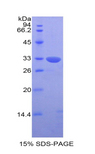 KIR2DS4 Protein - Recombinant Killer Cell Immunoglobulin Like Receptor 2DS4 By SDS-PAGE