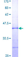 KIR3DL1 Protein - 12.5% SDS-PAGE Stained with Coomassie Blue.
