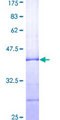 KIR3DL1 Protein - 12.5% SDS-PAGE Stained with Coomassie Blue.