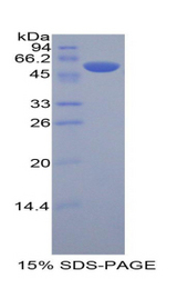 KIR3DL2 Protein - Recombinant Killer Cell Immunoglobulin Like Receptor 3DL2 By SDS-PAGE