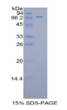 KIR3DL3 / CD158z Protein - Recombinant Killer Cell Immunoglobulin Like Receptor 3DL3 By SDS-PAGE