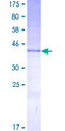 KISS1 / Kisspeptin / Metastin Protein - 12.5% SDS-PAGE of human KISS1 stained with Coomassie Blue