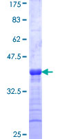 KISS1 / Kisspeptin / Metastin Protein - 12.5% SDS-PAGE Stained with Coomassie Blue.