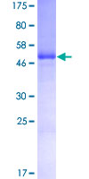 KITLG / SCF Protein - 12.5% SDS-PAGE of human KITLG stained with Coomassie Blue