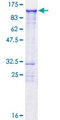 KIZ / PLK1S1 Protein - 12.5% SDS-PAGE of human C20orf19 stained with Coomassie Blue