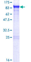 KLC2 Protein - 12.5% SDS-PAGE of human KLC2 stained with Coomassie Blue
