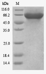 KLC3 Protein - (Tris-Glycine gel) Discontinuous SDS-PAGE (reduced) with 5% enrichment gel and 15% separation gel.